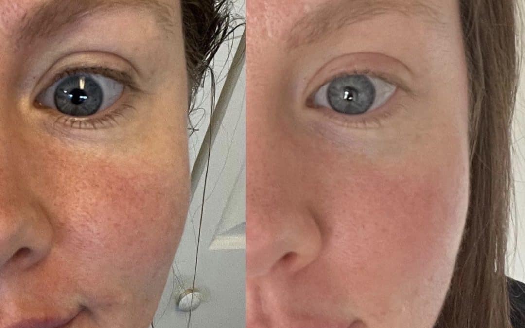 My Collagen Discovery